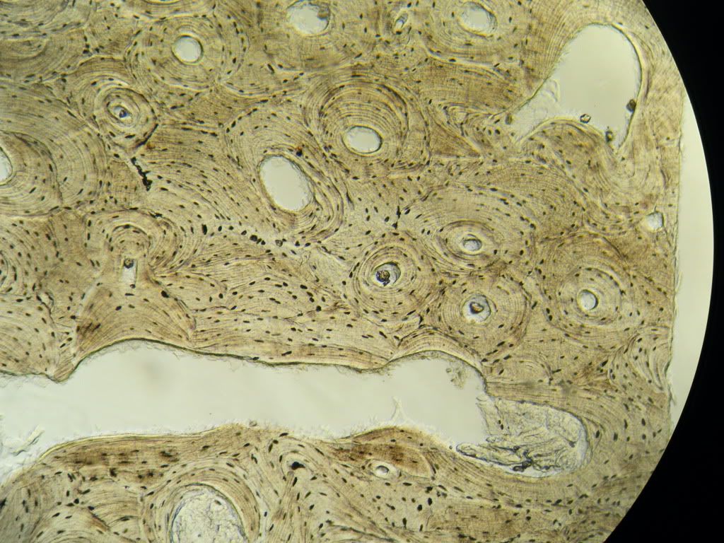 Yellow Elastic Tissue